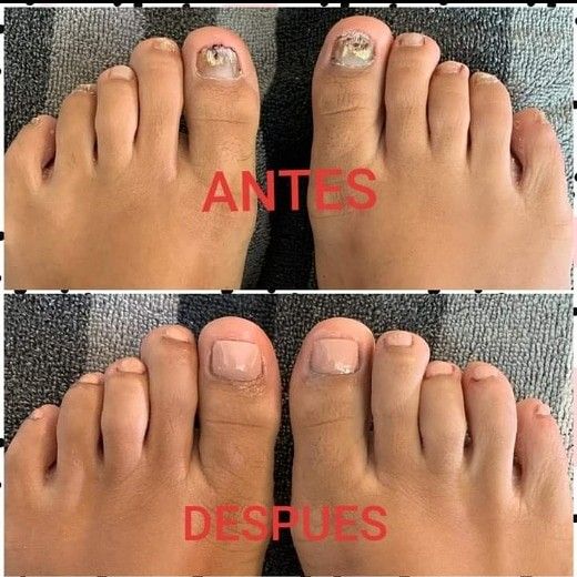 Tratamiento de Uñas de 7 Días 💅 Fortalece Tus Uñas Desde La Raíz ⭐ - 2 Unidades (2x1)