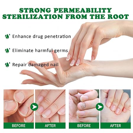 Tratamiento de Uñas de 7 Días 💅 Fortalece Tus Uñas Desde La Raíz ⭐
