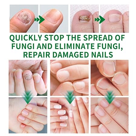 Tratamiento de Uñas de 7 Días 💅 Fortalece Tus Uñas Desde La Raíz ⭐