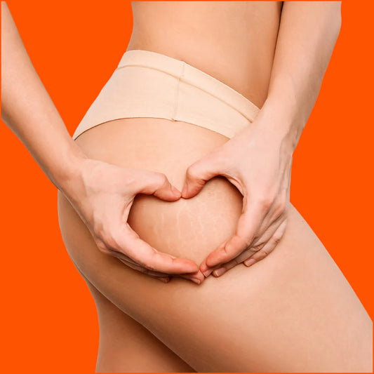 Bio-oil🌸 Siéntete Más Segura En Tu Propia Piel