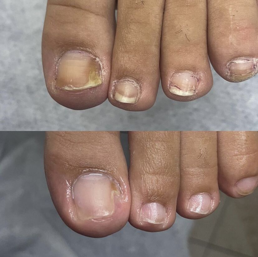 Tratamiento de Uñas de 7 Días 💅 Fortalece Tus Uñas Desde La Raíz ⭐ - 2 Unidades (2x1)