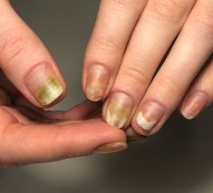 Tratamiento de Uñas de 7 Días 💅 Fortalece Tus Uñas Desde La Raíz ⭐ - 2 Unidades (2x1)