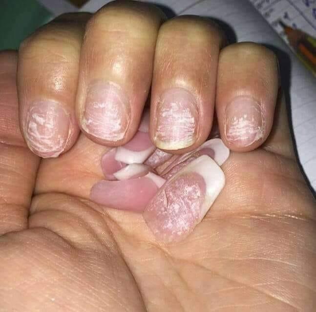 Tratamiento de Uñas de 7 Días 💅 Fortalece Tus Uñas Desde La Raíz ⭐ - 2 Unidades (2x1)
